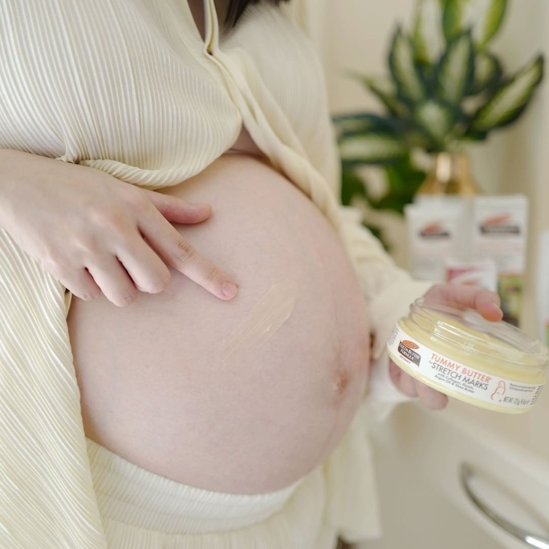 CÁCH NGĂN NGỪA RẠN DA HIỆU QUẢ, AN TOÀN KHI MANG THAI